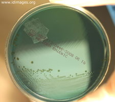 Figure 2.  <i>Shigella</i> colonies on Hektoen Enteric agar.