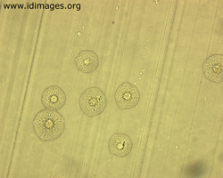 Figure 1.  Colonies of Mycoplasma species (10x magnification) on ureaplasma differential agar (A7).