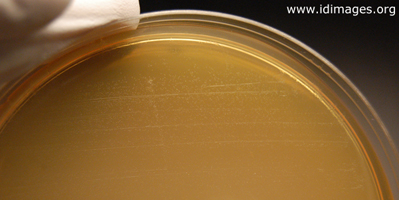 Figure 2.  Mycoplasma colonies on plate growth from anaerobic bottle of joint fluid.