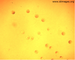 Figure 3. Mycoplasma growth from anaerobic bottle of joint fluid (4x magnification).
