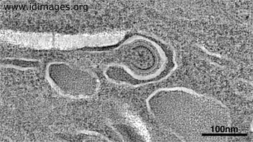 Figure 3.  Negative-stain, electron tomographic imaging of a budding HIV virion.