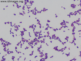Figure 4.  <i>R. equi</i> on gram stain of plate growth at 48 hours.