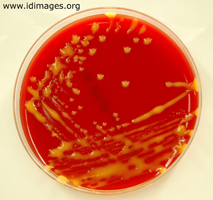 Figure 5.  <i>Rhodococcus equi</i> colonies on culture plate.