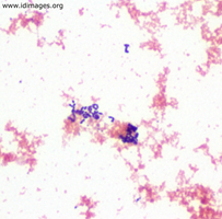 Figure 2.  Gram stain of <i>Actinobaculum schaalii</i>, grown in anaerobic blood culture bottle.