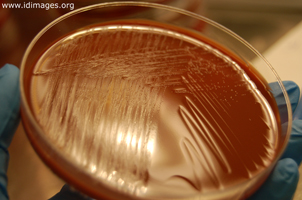 Figure 3. <i>A. schaalii</i>, growth on chocolate agar after 3 days, from blood culture specimen.