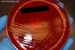 Figure 4.  <i>A. schaalii</i> growth after 3 days, from urine specimen subculture on blood agar TSA.